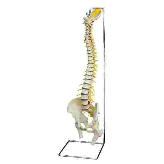 Spine with Slipped Disc / Anatomical Model