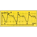 Swimsportec Schwimmgeschwindigkeits-Mess-System "Speedometer"