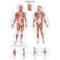 Erler Zimmer Anatomisk undervisningstavle Triggerpunkter