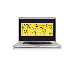 Swimsportec PC-Software „Bio SwimAnalysis“